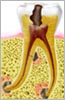 endodontiste