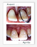 parodontologie